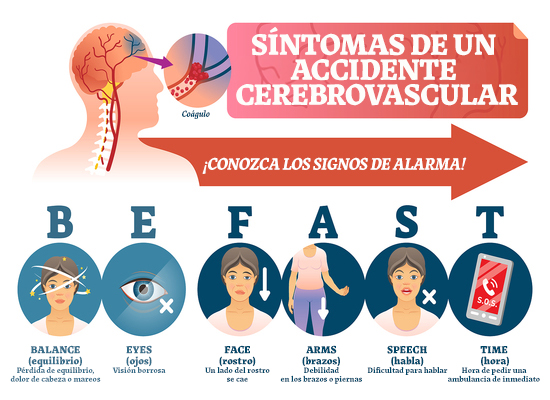 Gráfico con síntomas de un accidente cerebrovascular